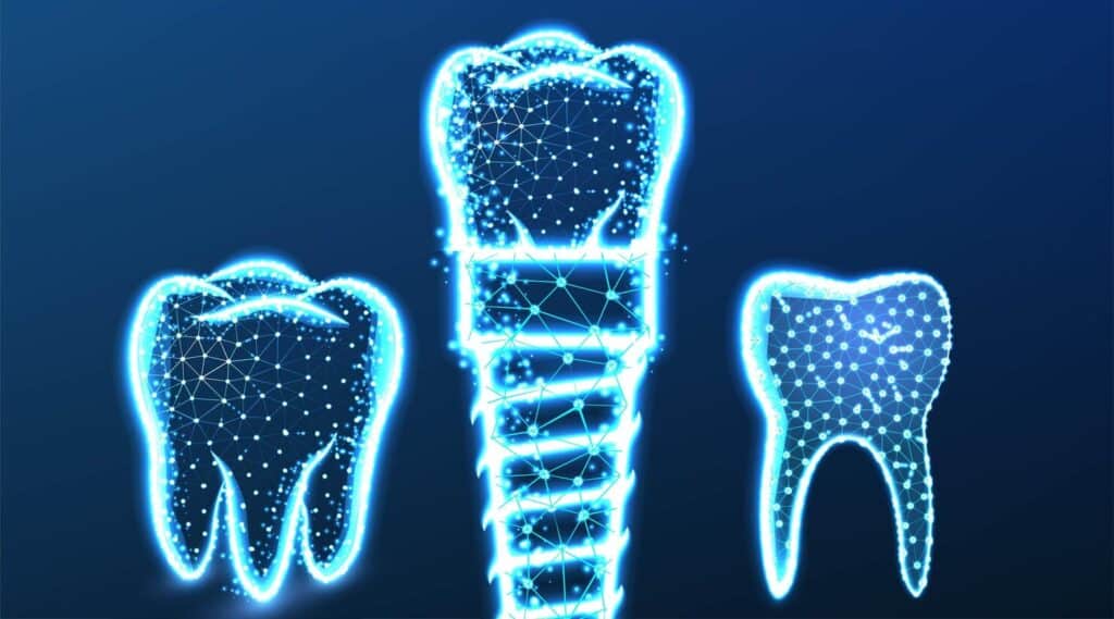 AI in dentistry dental industry innovation